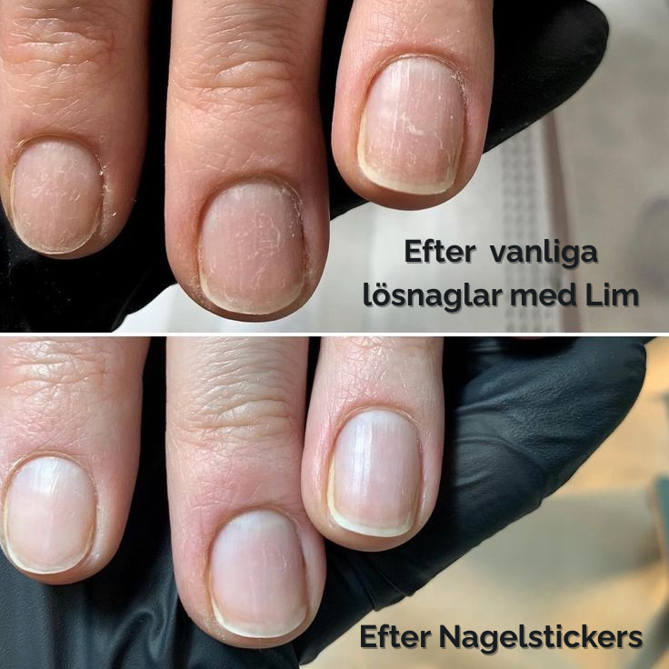 Självhäftande nagel-stickers